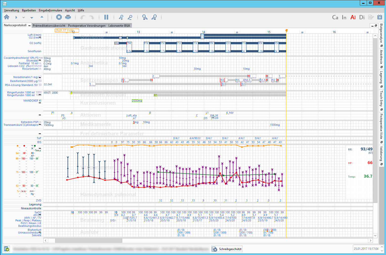 Beispielseite im Narkoseprotokoll.
