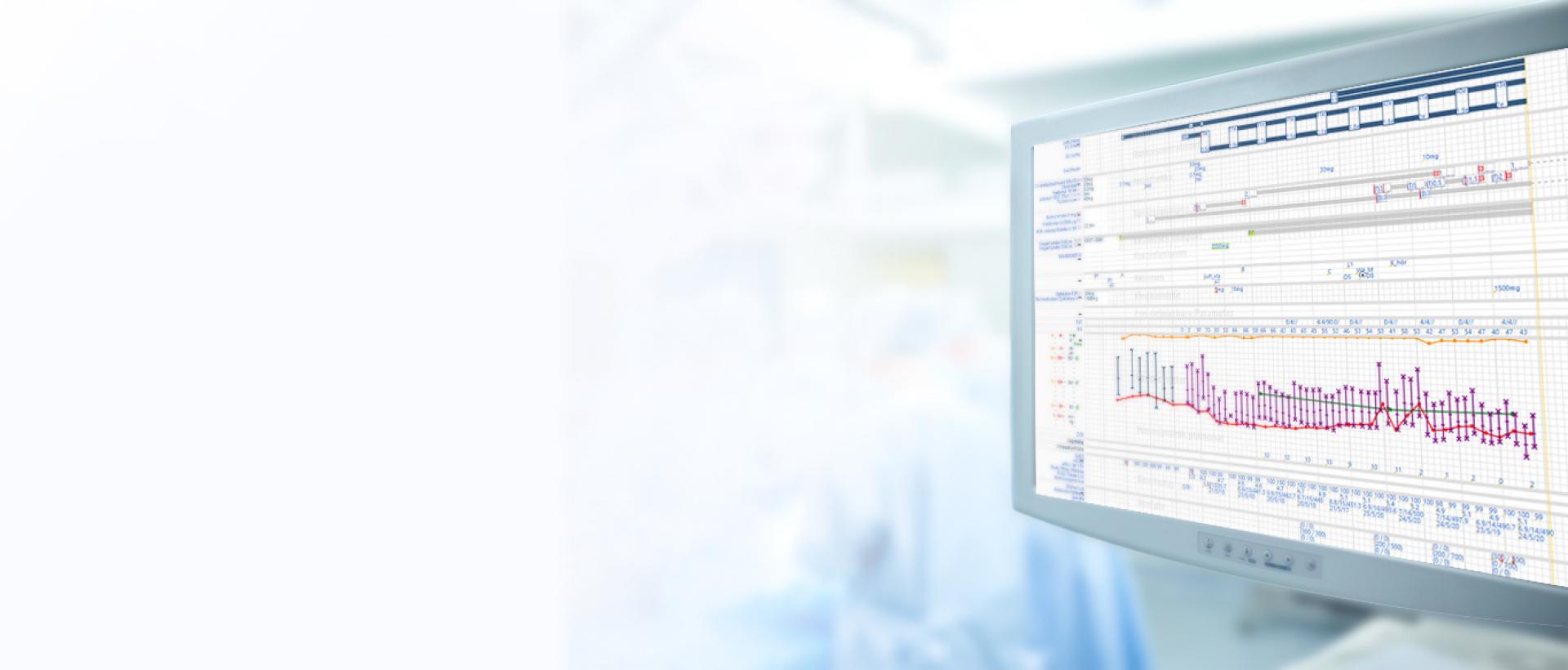 Teaser-Grafik: Monitor mit Graph-Darstellung